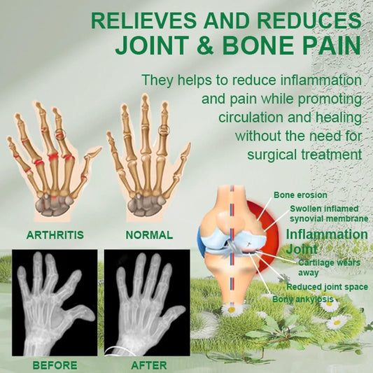Pain Relief Cream